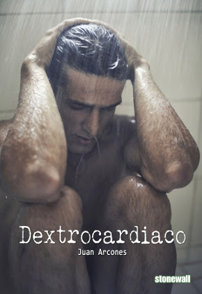 dextrocardiaco
